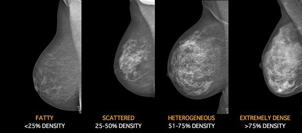 breast-density